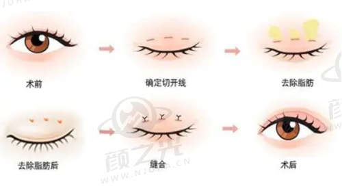 北京艺美王东医生服务体验与预约须知有哪些？