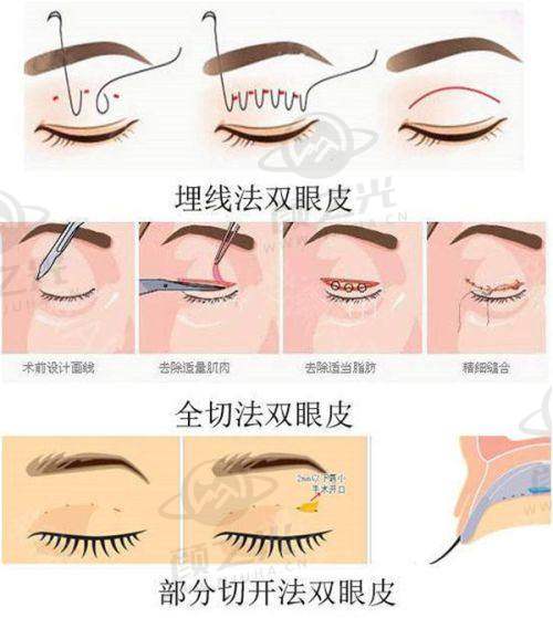 北京艺美医疗美容诊所服务是否优质？