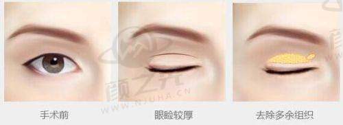 昆山玥美医疗美容的环境与设备怎么样?