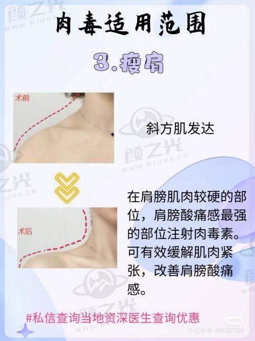 深圳非凡医疗美容医院王天成怎么样?20 余年经验,多领域技术出色获好评