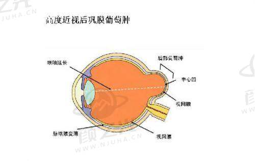 2025北京同仁医院眼科医生排名榜揭晓！前十医生及前五详细介绍快来了解！ 