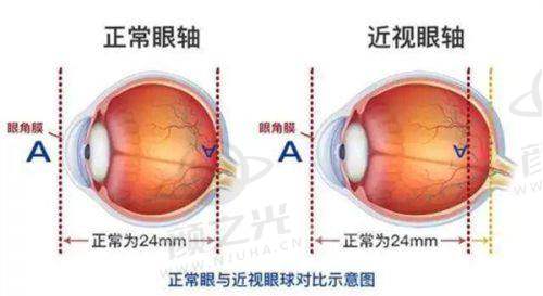 杭州友华普惠眼科医院技术实力
