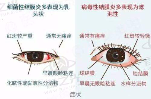 二、2025 北京同仁医院眼科医生排名榜（前十名）