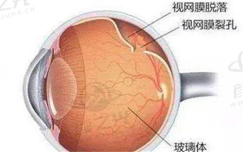 临汾洛基眼科医院是公立医院吗？收费贵吗？一篇文章给你靠谱答案！