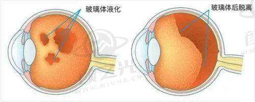 南宁华厦视光眼科医院是几级医院？二级眼科，2025 收费 + 医生实力全揭秘
