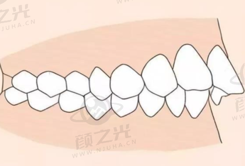 四、新疆伊宁福宏林口腔诊所特色项目