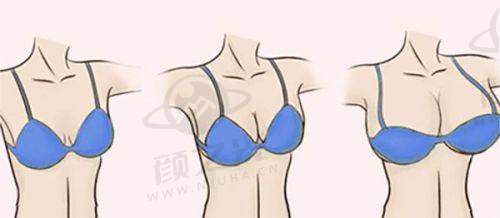 五、恩施美年华优惠活动