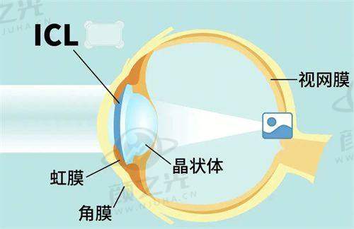 郑州奥弗克眼科医院交通路线指南