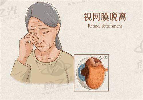 宁波爱尔眼科最厉害三个医生是谁？李小萍/高森/徐蕾技术实力大揭秘，附营业时间