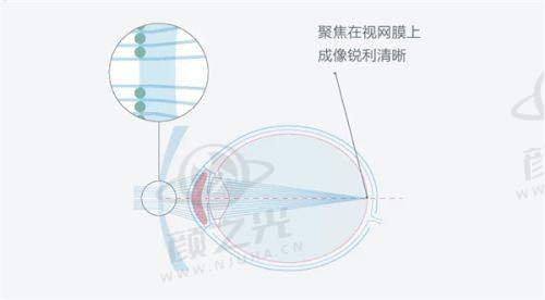 成都华厦眼科医院是正规私立的，多专科诊疗，近视手术多样，价格透明，值得信赖！ 