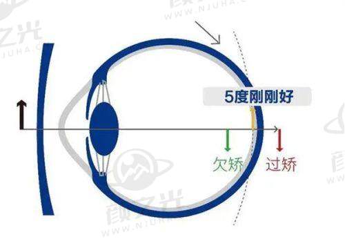 四、成都华厦眼科医院近视手术价格