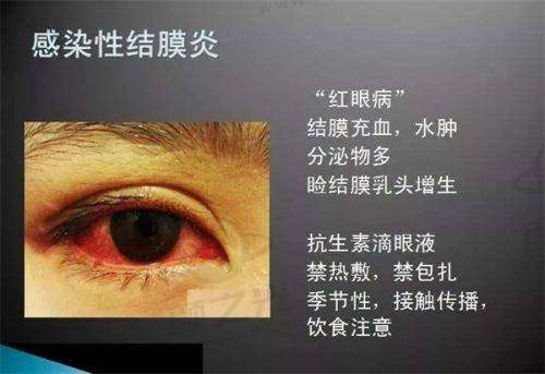 宿松中凯眼科医院是医保定点吗？支持哪些眼科项目报销？附收费及医生团队介绍
