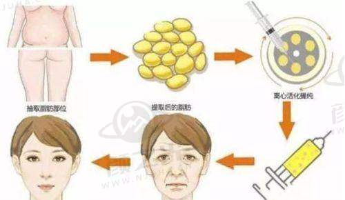 深圳联合丽格赵亮祥院长有多牛？二十余载临床积淀，零淤青技术，学术担当一览无余！ 
