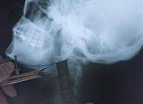 七、广州雅妍时光资讯攻略早知道