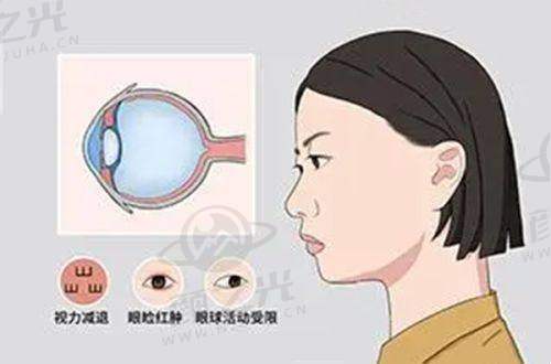 东莞华厦眼科医院靠谱吗？科室全、设备先进、专家多，为您眼睛健康保驾护航！ 
