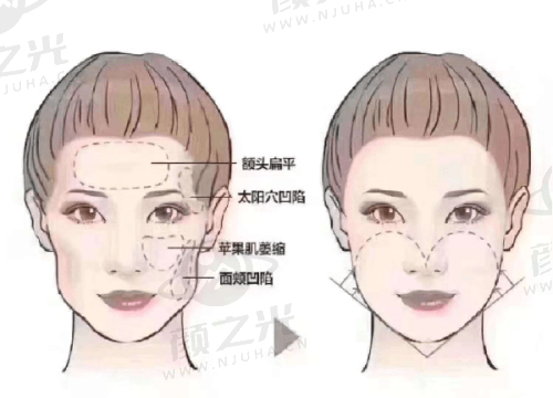 济南韩氏王召东医生实力揭秘！临床经验丰富，拉皮手术优势多值得考虑！ 