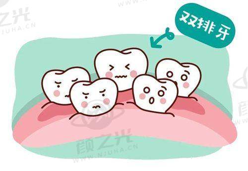 苏州英博口腔怎么样？正规连锁、项目全、服务优，费用参考及恢复情况揭秘！ 