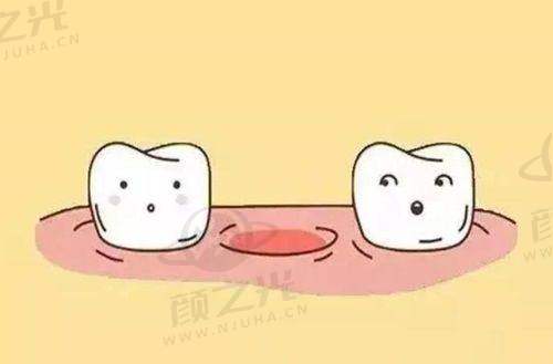 五、如何选择