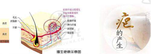 重庆郑荃丽格疤痕修复中 心技术设备