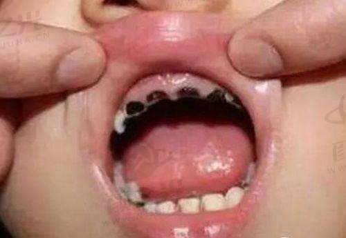 信阳牙博仕口腔门诊部