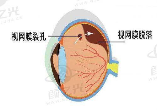 三、呼和浩特朝聚眼科医院地址电话及就诊攻略
