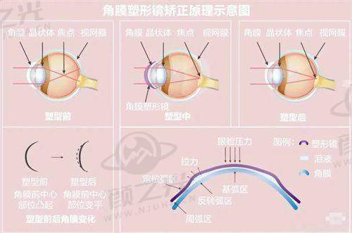 四、沈阳四院眼科挂号预约平台注意事项