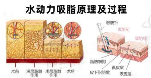 武汉江城整形外科医院的优势：靠谱没商量