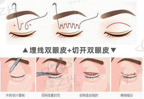 义乌欧莱美美容医院在哪里？总部在江滨西路，还提供免费停车等福利 