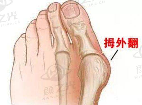 五、全息六维层离清奥术揭秘