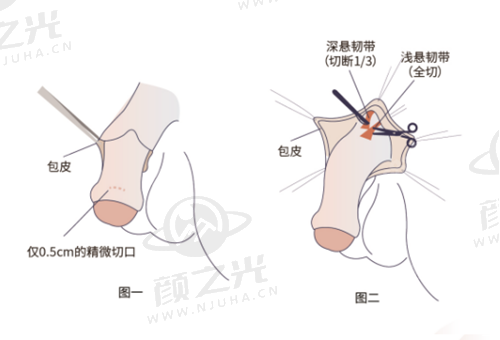 五、呼和浩特科益瘢痕整形医院特色服务