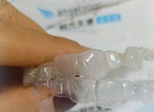 二、燕郊紫丁香口腔：连锁品牌的实力担当