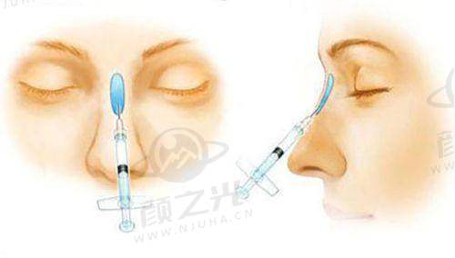 激光紧缩和手术紧缩的区别是什么？从原理、效果到风险，全方位解析！ 