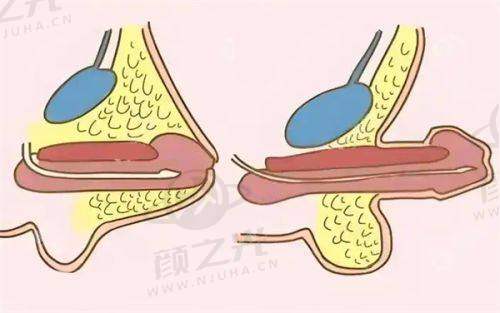 美学建议与注意事项