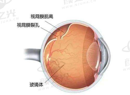 四、龙岩爱尔眼科医院医生团队