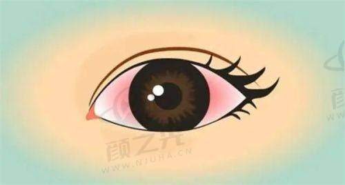 桂林爱尔眼科医院骨干医生团队实力怎样？