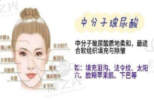 青岛华韩整形医院双眼皮修复咋样啊？实力强、医生牛，多数患者效果满意！ 