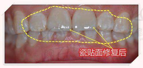 三、沈阳纽大口腔门诊部：专精严谨的诊疗体系