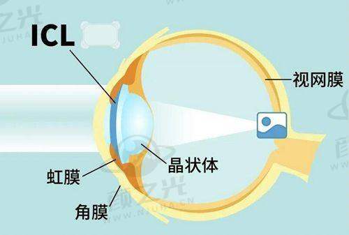 五、哈尔滨爱尔眼科医院预约挂号服务