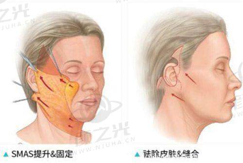 十、给求美者的建议，理性判断真相