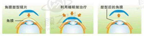 杨培增医院地址与预约方式