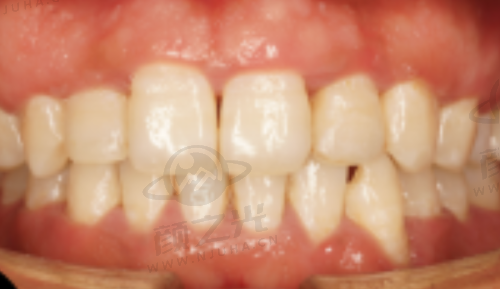 成都新桥口腔医院收费高吗？连锁规模大+医保定点，种牙矫正价格表一览 