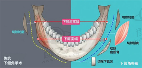 二、手术建议：成都成优选之地