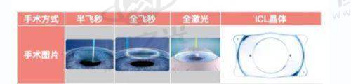 西安西 京医院眼科近视手术费用都包含啥？