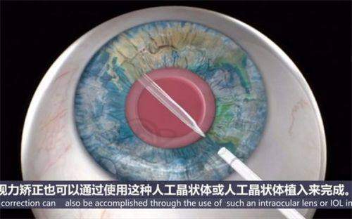 周口市眼科医院交通及预约