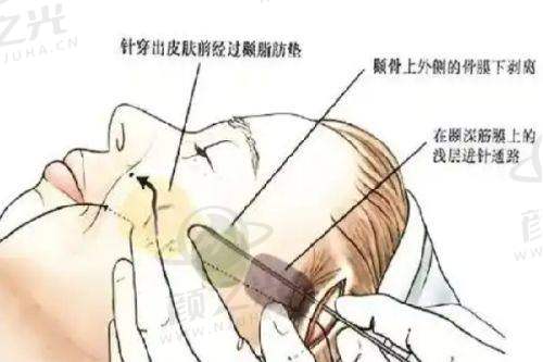 2025广东省第二人民医院整形科大揭秘！专家团队+价格咨询全攻略