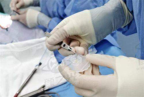 东莞爱尔眼科医院近视手术成效好吗？