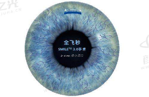 昭通市中医院眼科怎么预约？线上线下全攻略，轻松挂号就诊