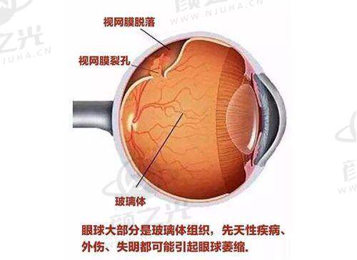 不同地区眼科收费对比,崇左性价比极高