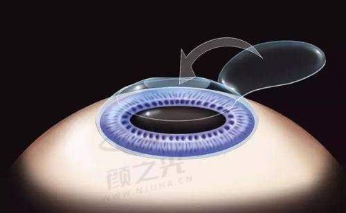 柳州工人医院眼科团队及价格参考