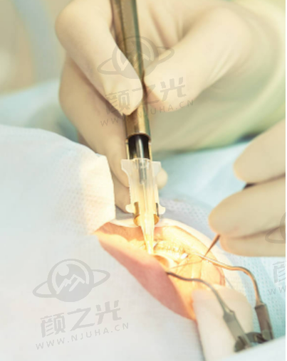 洛阳一院眼科预约挂号指南：线上线下全流程解析，轻松就诊